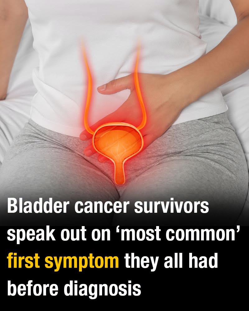 Bladder cancer survivors speak out on ‘most common’ first symptom they all had before diagnosis