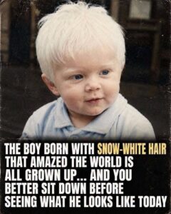 Unforgettable White-Haired Boy
