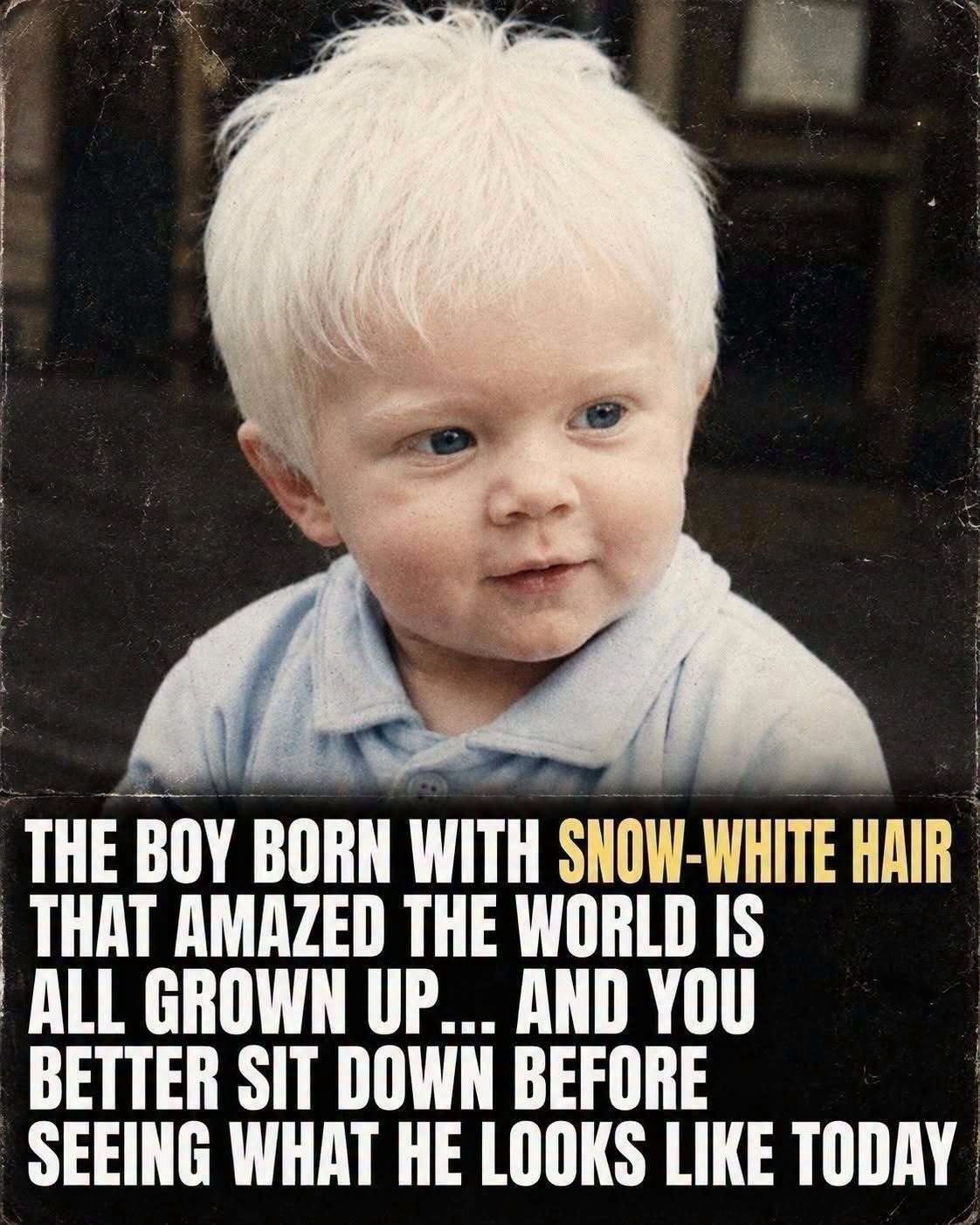 Unforgettable White-Haired Boy