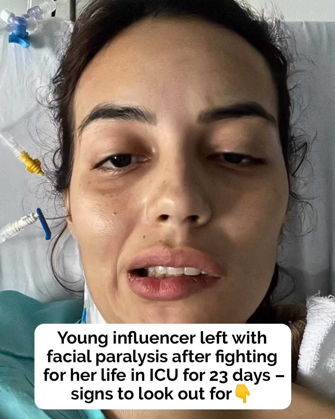 Influencer left partially paralyzed allegedly after eating sushi