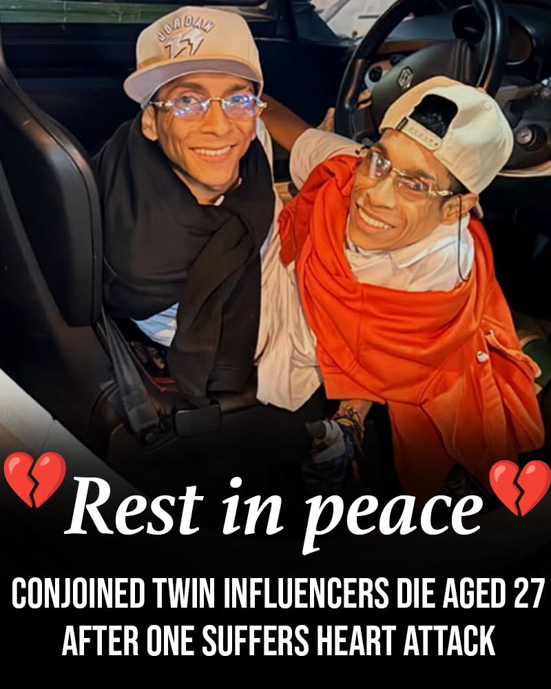 Conjoined twin influencers die aged 27 after one suffers heart attack