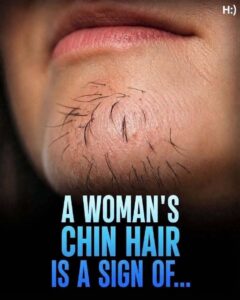 A Woman’s Chin Hair Could Be a Sign of More Than Just Aging, Experts Say
