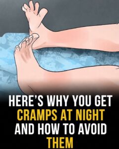 Why You Get Leg Cramps at Night — And What You Can Do to Prevent Them