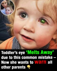 Toddler’s eye ”melts away” after wrong person kissed him