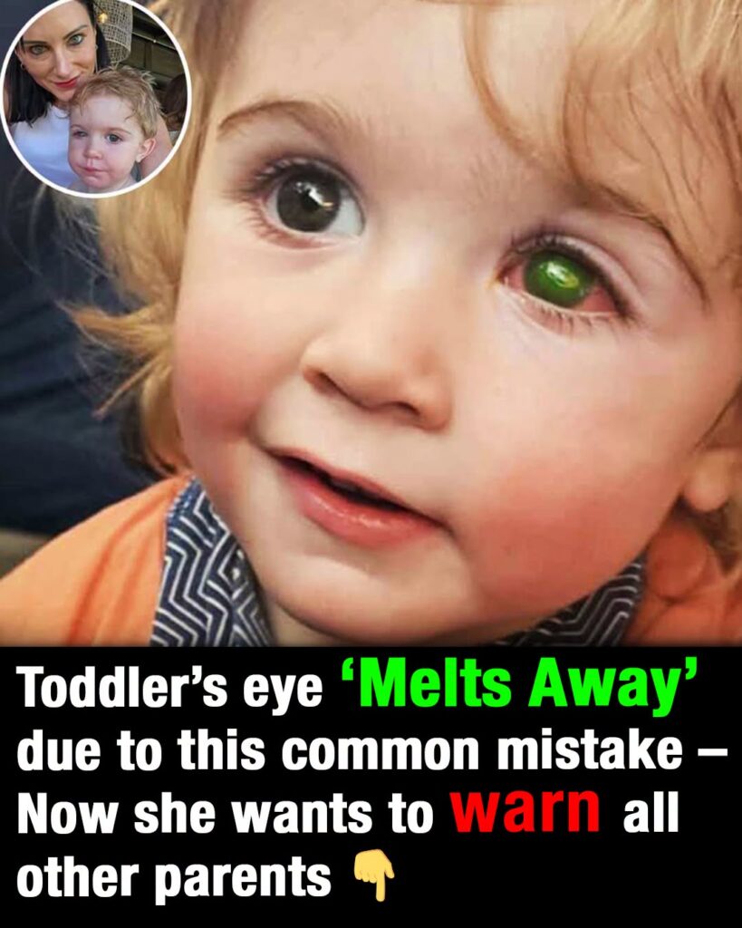 Toddler’s eye ”melts away” after wrong person kissed him