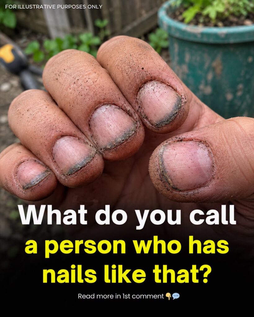 What Do Dirty Fingernails Really Say About a Person?