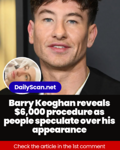 Barry Keoghan reveals $6,000 procedure as people speculate over his appearance
