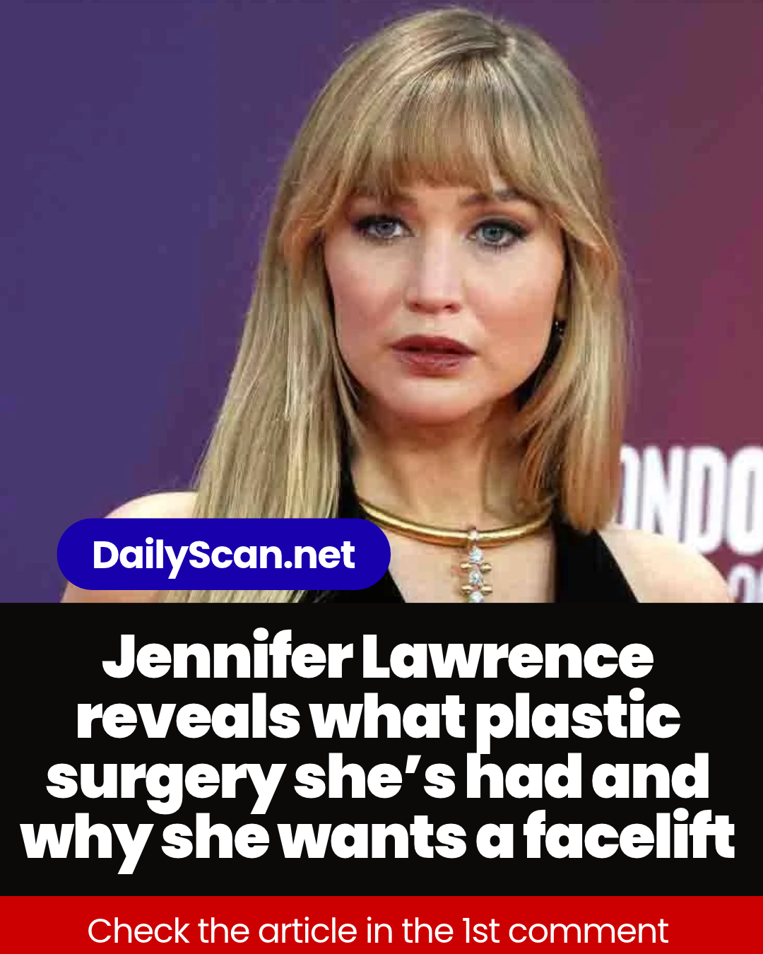 Jennifer Lawrence reveals what plastic surgery she’s had and why she wants a facelift