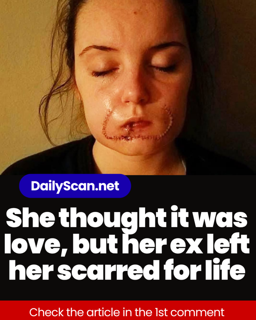 She thought it was love, but her ex left her scarred for life